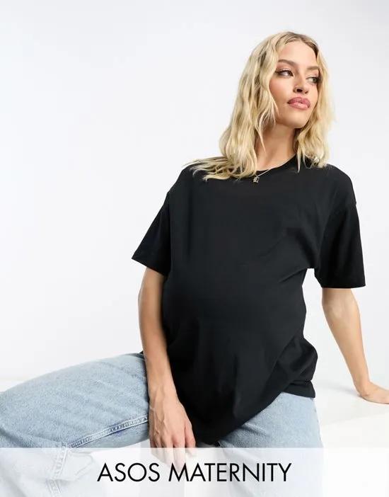 ASOS Design Maternity oversized T-shirt in black